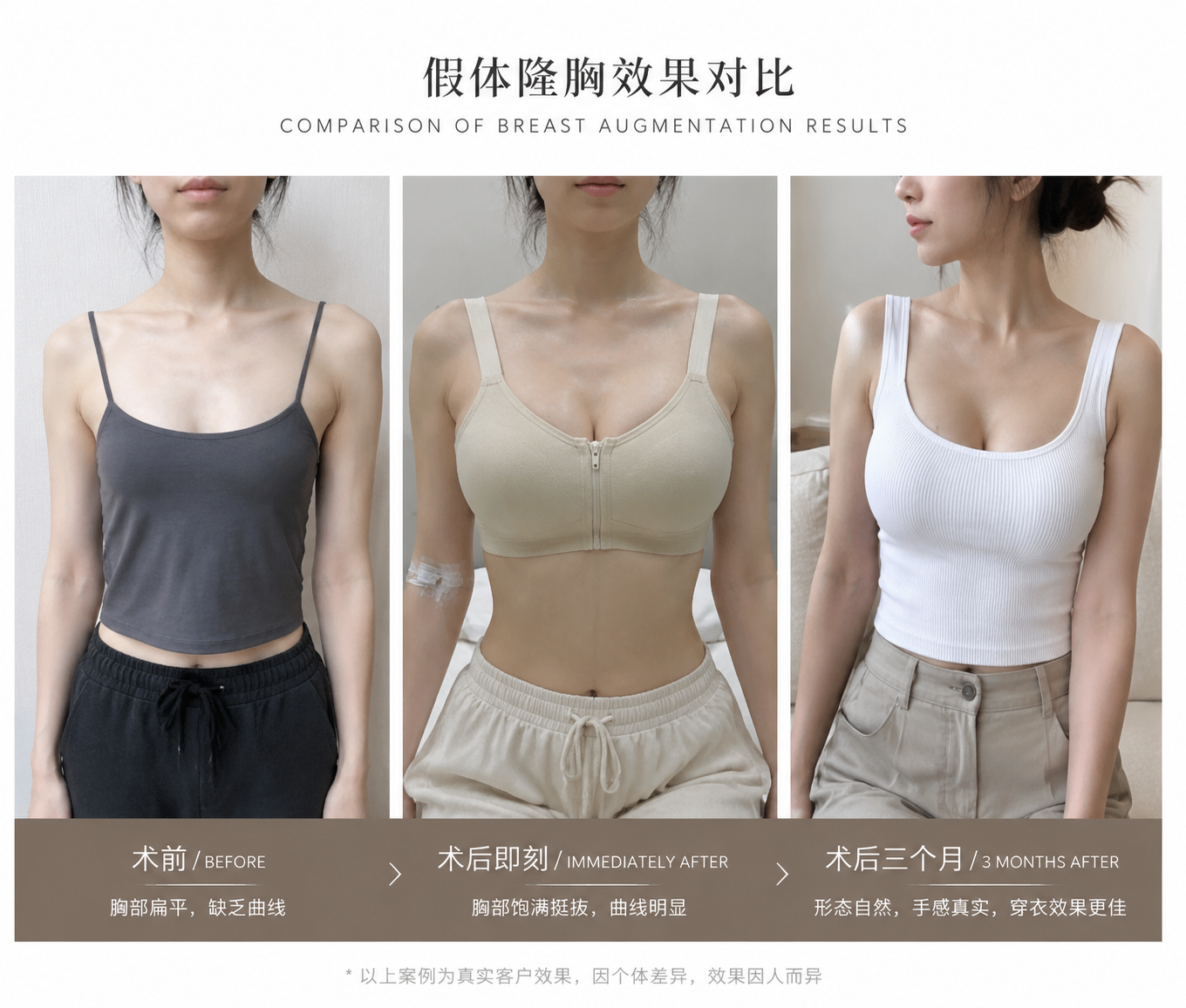 Breast Aesthetics results