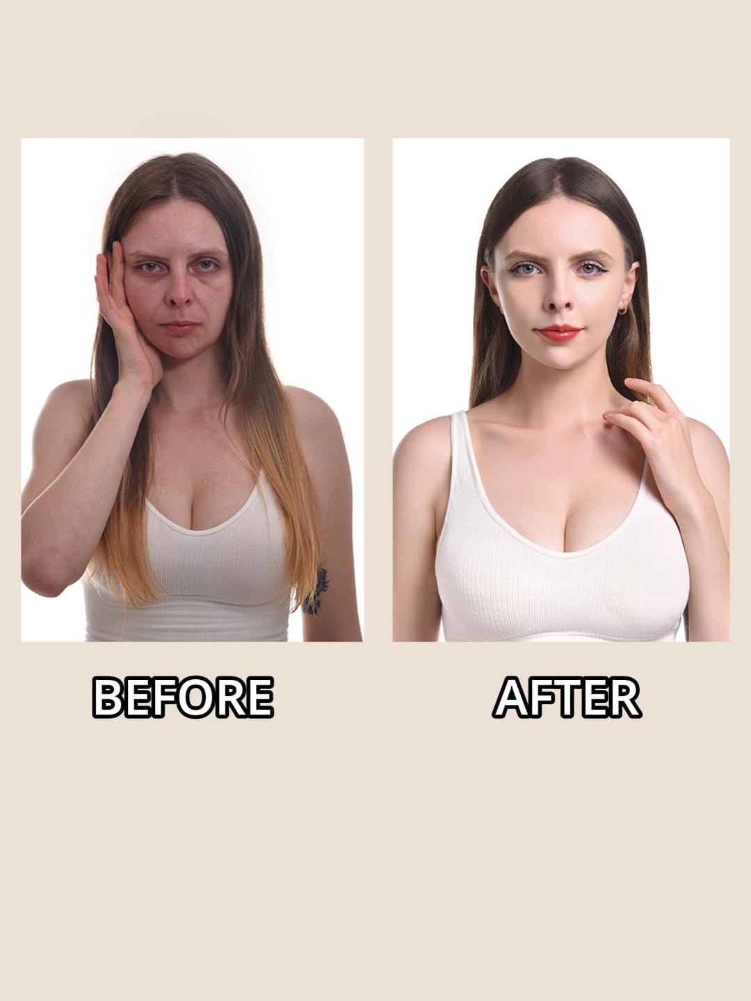 Facial Rejuvenation results
